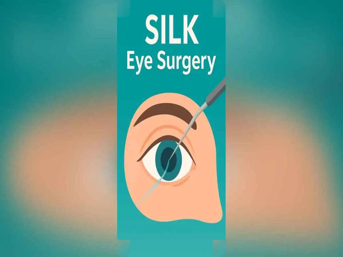 Eye surgery with laser overlaid on eye and lens